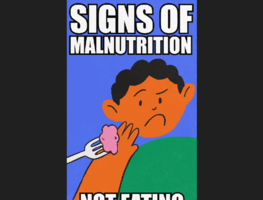 Signs of Malnutrition- Mali MUAC GIF